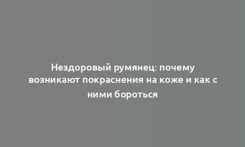 Нездоровый румянец: почему возникают покраснения на коже и как с ними бороться